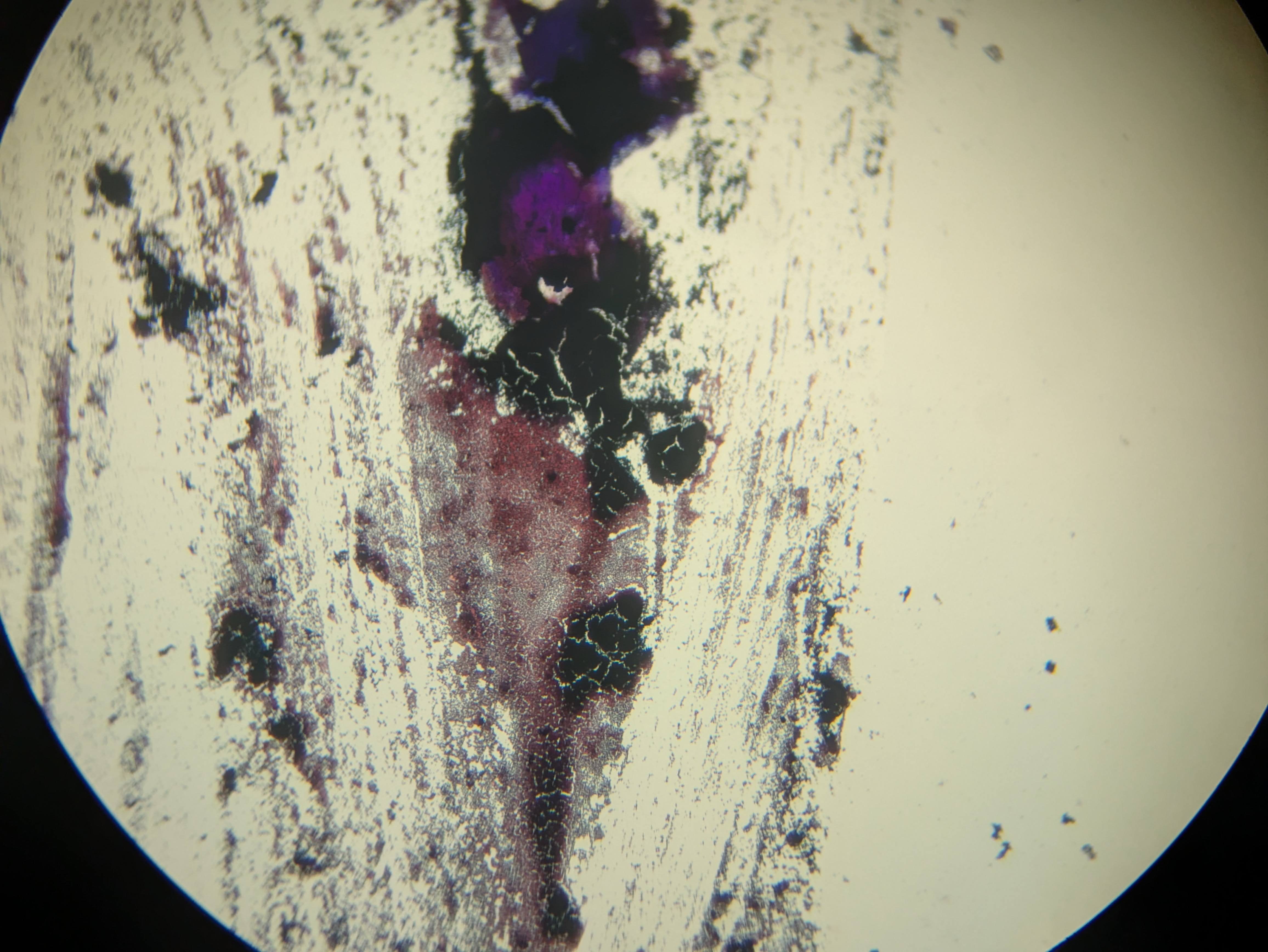 A messy first gram stain