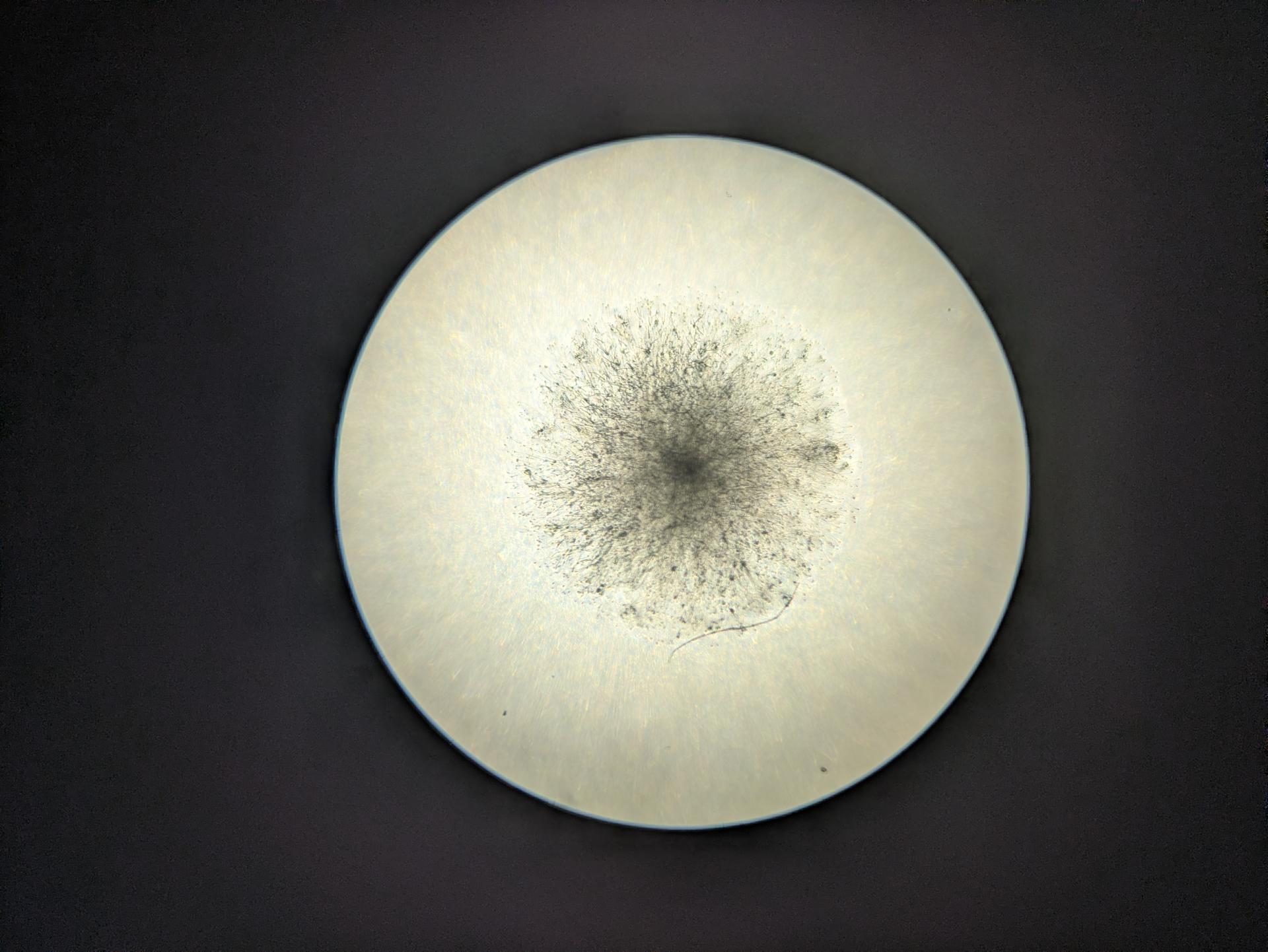 Contam on one plate, possibly from me opening it a bunch of times to look hopefully for colonies