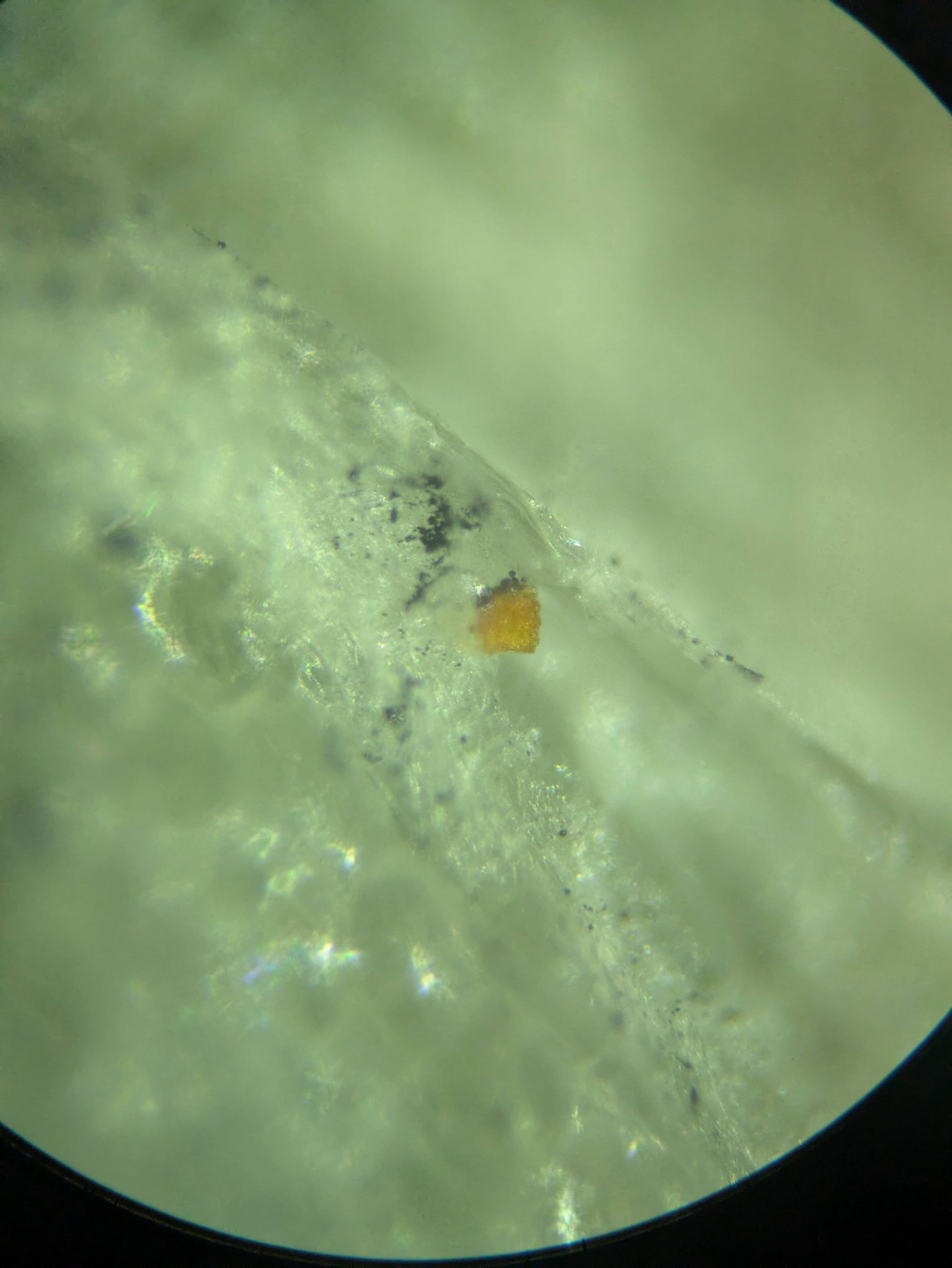 Reddish blob? Part of the onion? Or something external? I think the latter